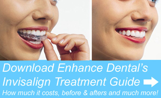 Exploring the Benefits of Availing Suitable Treatments from Invisalign  Dentist Melbourne, by Preston Smiles Dental