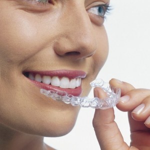 Braces vs Invisalign® - Melbourne MD