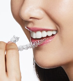 Clear Braces — Dentist Melbourne  Invisalign + Teeth Whitening + Clear  Braces