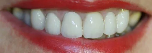 Enhance Dental Melbourne