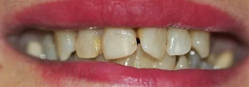 Enhance Dental Melbourne