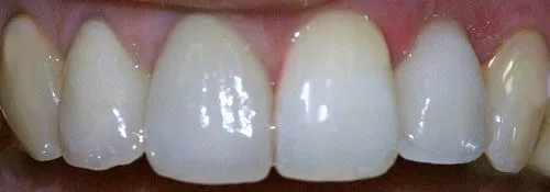Enhance Dental Melbourne