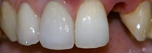 Enhance Dental Melbourne