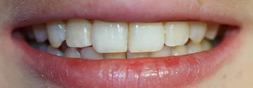Enhance Dental Melbourne