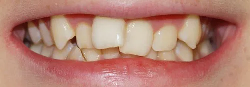 Enhance Dental Melbourne