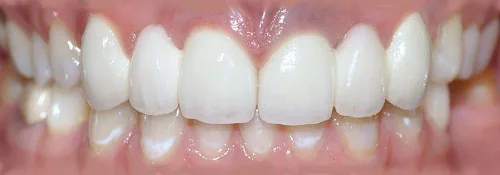 Enhance Dental Melbourne