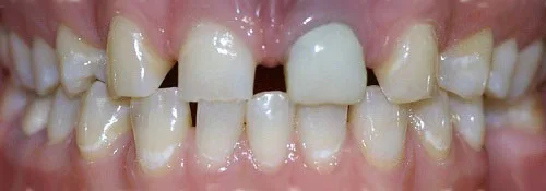 Enhance Dental Melbourne