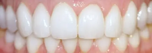 Enhance Dental Melbourne