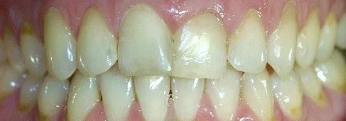 Enhance Dental Melbourne