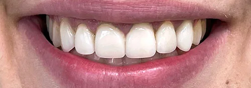 Enhance Dental Melbourne
