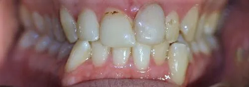 Enhance Dental Melbourne