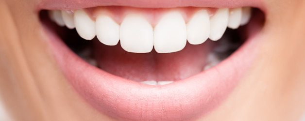 Invisalign